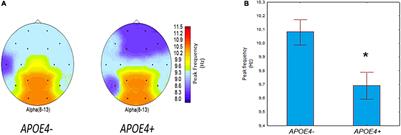 Genetic association of apolipoprotein E genotype with EEG alpha rhythm slowing and functional brain network alterations during normal aging